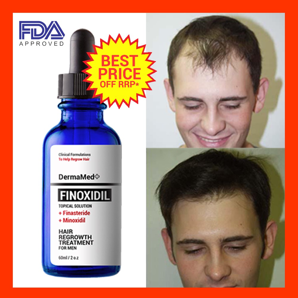 finasteride liquid price