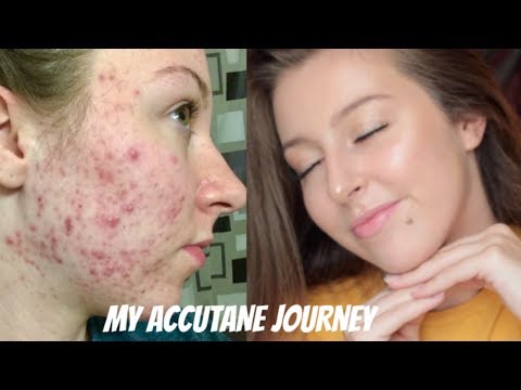 Price Of Accutane 20mg