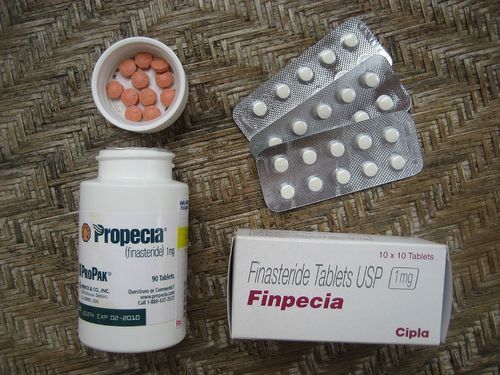 Finasteride price