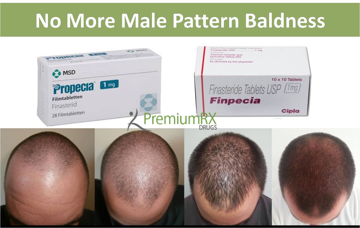 Is finasteride generic