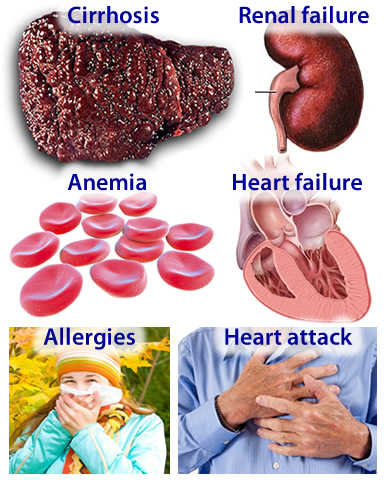 metformin by online